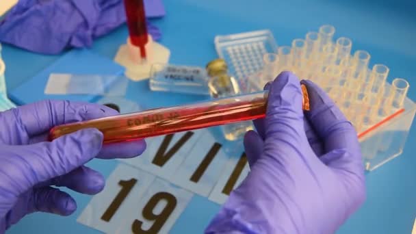Coronavirus covid-19 probeta con muestra de sangre girando en la mano con guante médico en detalle
 - Imágenes, Vídeo