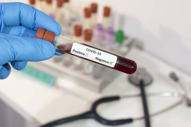 Uma mão segura um tubo de teste com um resultado negativo no teste de sangue para o novo Coronavirus. A vacina está mais próxima
 - Foto, Imagem