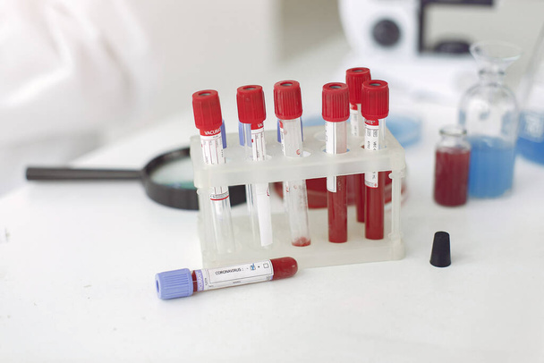 Coronavirus-Testproben mit Flaschenlösungen im Inneren und einer Lupe auf einem Tisch - Foto, Bild