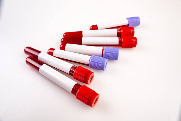 Blood tube with sample blood - Foto, imagen