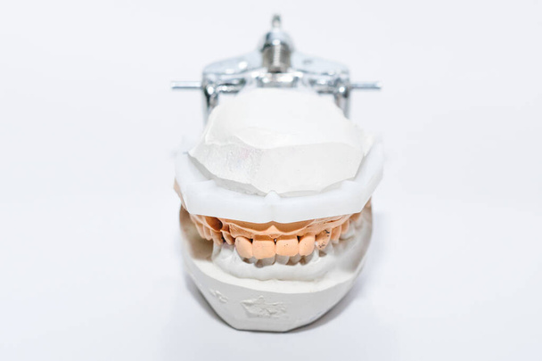 Gipsabguss der Kiefer. Gips-Gips-Modell menschlicher Kiefer im Prothesenlabor. Zahnheilkunde, Kieferorthopädie. Aus nächster Nähe. Selektiver Fokus. - Foto, Bild