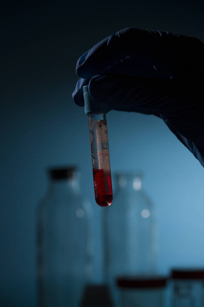 研究者の手は、コロナウイルス2019-nCOVテストの血液と試験管を保持しています。急速に普及しているコロナウイルスの血液検査結果 - 写真・画像