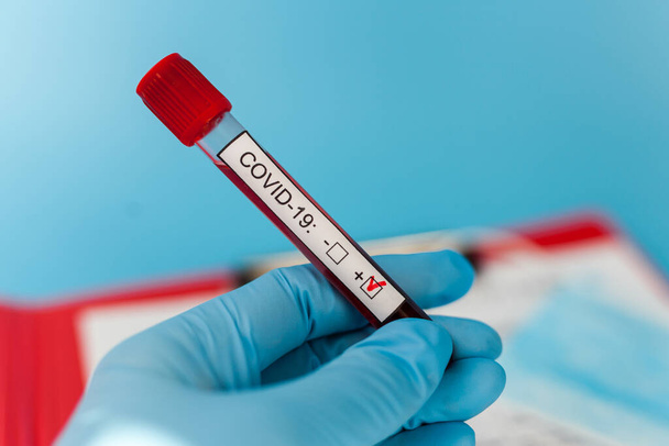 Krevní výsledek trubice v ruce lékař mers cov coronavirus test pozitivní štítek v nemocnici. Nový rychle se šířící Coronavirus, světová pandemie. - Fotografie, Obrázek