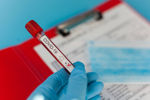 Blood result tube in doctor hand mers cov coronavirus test positive label in hospital. New rapidly spreading Coronavirus, world pandemic. - Valokuva, kuva