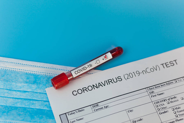 急速に普及しているコロナウイルス、世界的なパンデミックのための積極的な血液検査結果. - 写真・画像