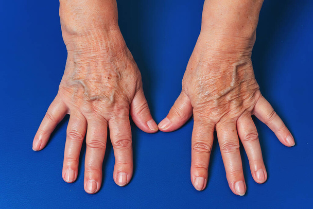 Mavi arka planda oturan yaşlı bir kadının elleri. Yaşlı kadının ellerindeki damarlar. Kadın elleri. - Fotoğraf, Görsel