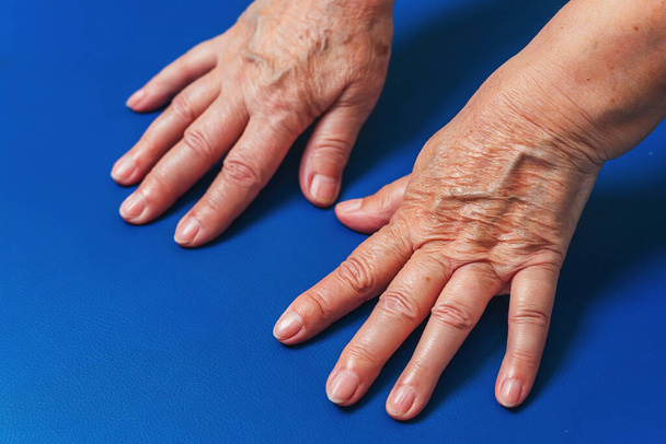 Mains d'une femme âgée sur fond bleu gros plan. Des veines sur les mains de la vieille femme. Mains féminines
 - Photo, image