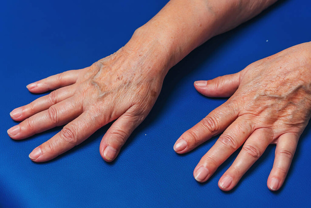Hands of an elderly woman on a blue background close-up. Veins on the old woman's hands. Female hands - Photo, Image