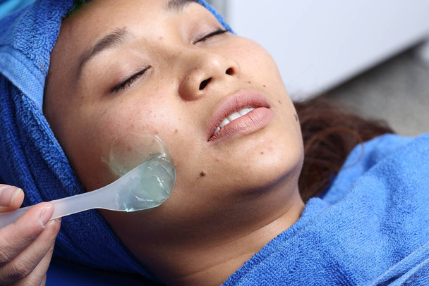 アジアの女性の治療は、患者として肌を滑らかに明るくし、病院のクリニックで顔に医療機器の冷たいプロセスでにきびを治す - 写真・画像