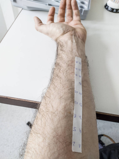 Teste de picada de pele alérgica em laboratório
 - Foto, Imagem