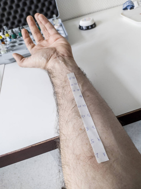 Allergiás bőrszúrásos teszt laboratóriumi körülmények között - Fotó, kép