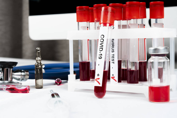 Positive coronavirus blood test concept. Analyzing blood sample in test tube for coronavirus test. Tube with blood for 2019-nCoV or COVID-19 test. Coronavirus blood analysis concept. - Fotografie, Obrázek