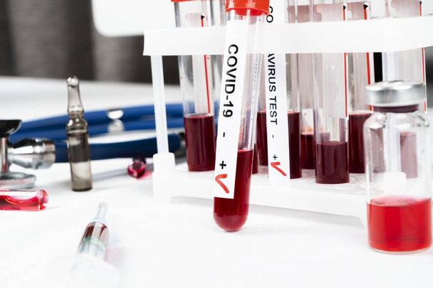 Positive coronavirus blood test concept. Analyzing blood sample in test tube for coronavirus test. Tube with blood for 2019-nCoV or COVID-19 test. Coronavirus blood analysis concept. - Photo, image
