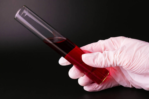 Tubo de ensayo con un análisis de sangre en la mano de un médico sobre un fondo negro
. - Foto, Imagen