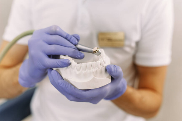 Dişçi bir implantla matkap tutuyor. Diş hekimliği bürosundaki hasta dişleri için diş matkabının yakın plan kullanımı. - Fotoğraf, Görsel