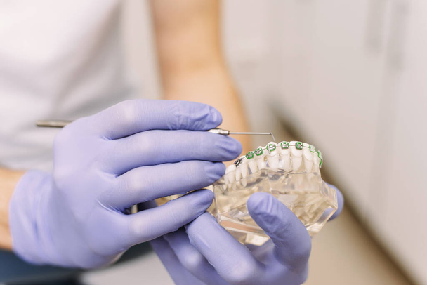 The dentist shows an artificial model of the jaw with braces. How to properly care for the oral cavity, put braces, cost and consequences. - Fotografie, Obrázek
