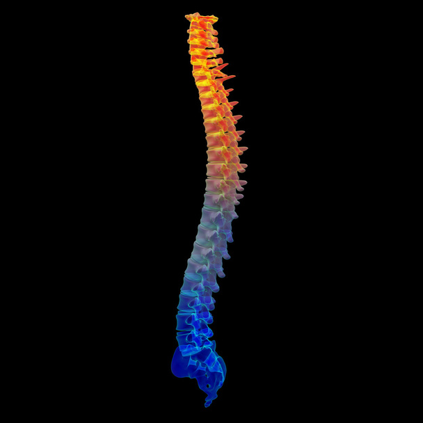 3d render painful spine - Photo, Image