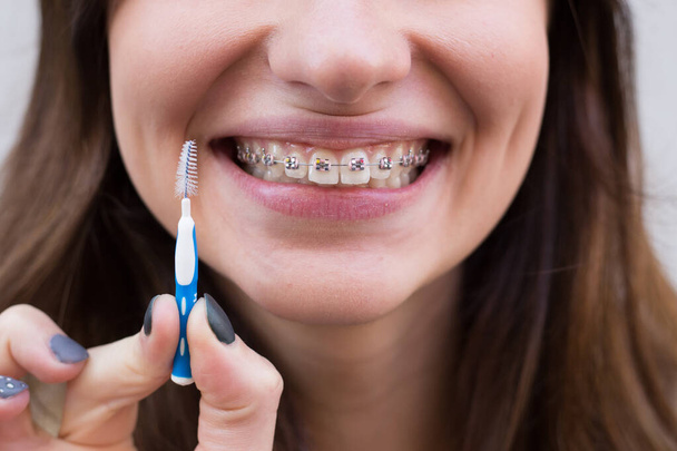 Красива молода дівчина з металевими брекетами для зубів з білими зубами і пензлем
 - Фото, зображення