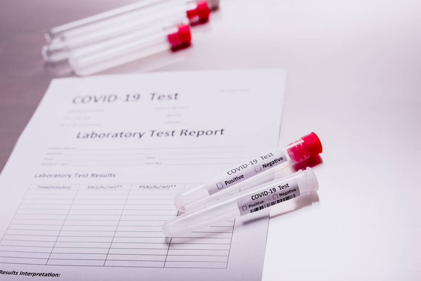 Os Estados Unidos sob a ameaça do coronavírus global covid-19 pandemia realiza milhares de testes em pacientes
. - Foto, Imagem