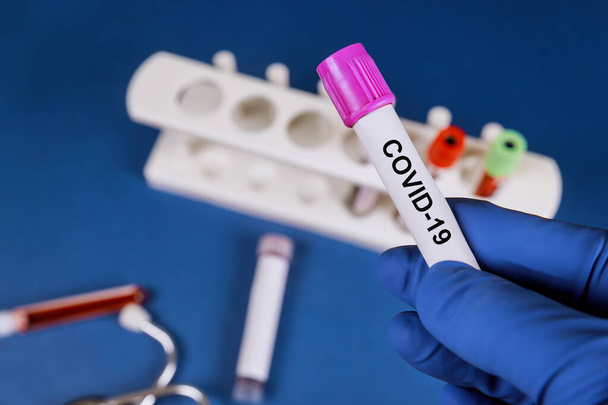 Medical test-tube with Coronavirus Covid 19 infected blood sample - Φωτογραφία, εικόνα