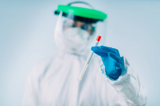 Набор для тестирования коронных вирусов - Образец мазка для ПЦР ДНК
  - Фото, изображение