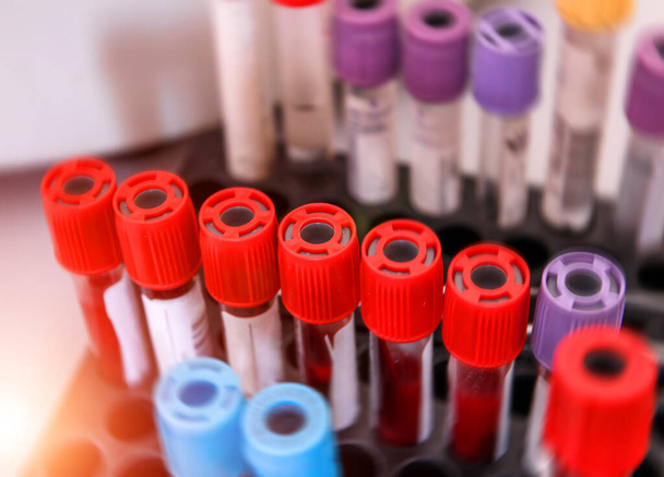 Tubes of blood sample for testing. - Fotó, kép