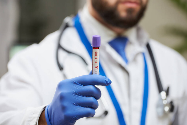 Sakallı bir bulaşıcı hastalık doktoru elinde koronavirüs kan örneği gösteriyor. Pozitif COVID-19 kan tüpü testinin yakın plan fotoğrafı.. - Fotoğraf, Görsel