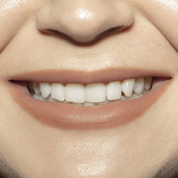 Close-up female mouth with natural nude gloss lips make-up. Cosmetology, dentistry and beauty care, emotions - Foto, Bild