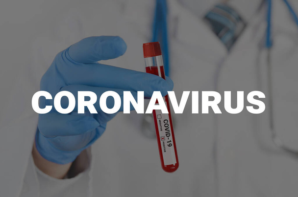 Doctor holds a test tube. Blood test, positive corona virus test - Photo, image