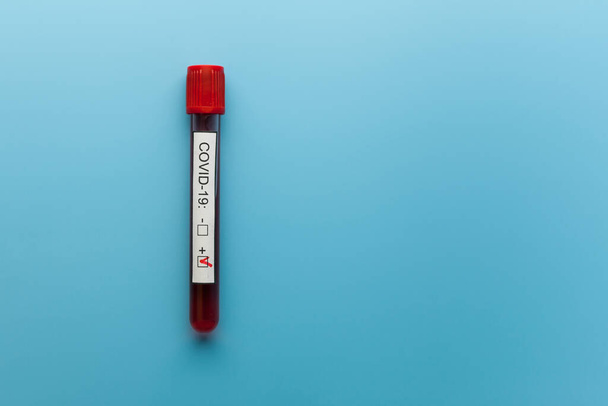 Blood test result tube on the blue doctor desk for the new rapidly spreading Coronavirus, world pandemic. - Valokuva, kuva