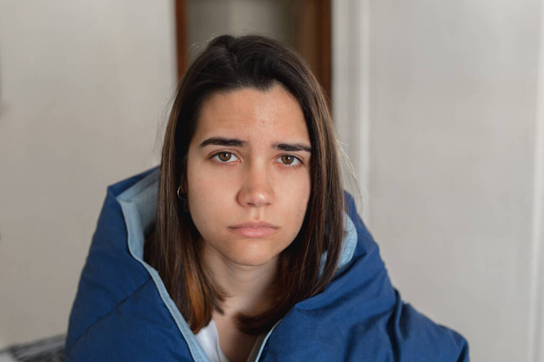 スペインの隔離中に回復のために家に滞在するコロナウイルスに感染した若い病気の女性。にきびやシミの悪い顔 - 写真・画像