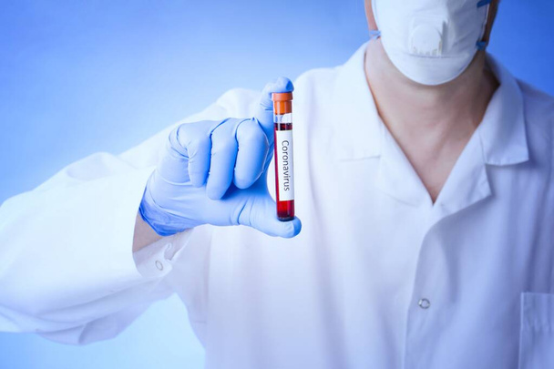 Coronavirus blood test result, blood infected with coronavirus in vacuum test tube in doctors hands with text Coronavirus in laboratory. - Photo, image
