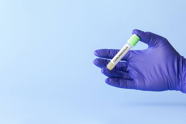 test tube in hand of lab technician with sample of coronavirus covid-19, deadly global pandemic concept - Photo, image