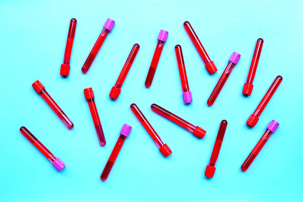 Blood in test tubes on blue background. Top view - 写真・画像