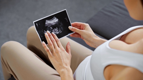 Vista recortada de la niña embarazada tocando ultrasonido escaneo del bebé
  - Metraje, vídeo