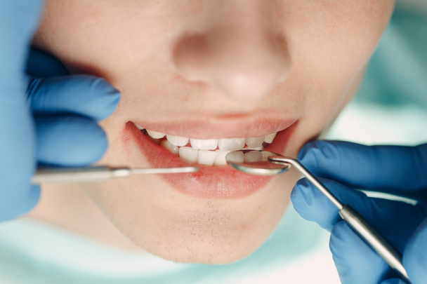 Zahnmedizin. Zahnarzt und Patient. Zahnklinik. Zähne zusammenbeißen. - Foto, Bild