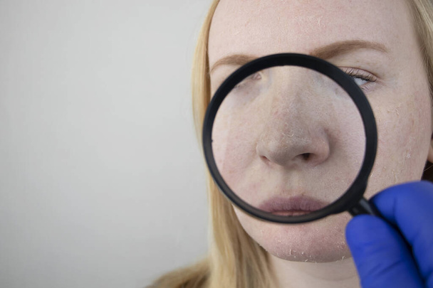 Een vrouw onderzoekt de droge huid op haar gezicht. Schillen, grof worden, ongemak, gevoeligheid van de huid. Patiënt bij de benoeming van een dermatoloog of cosmetoloog, selectie van crème voor droogheid - Foto, afbeelding