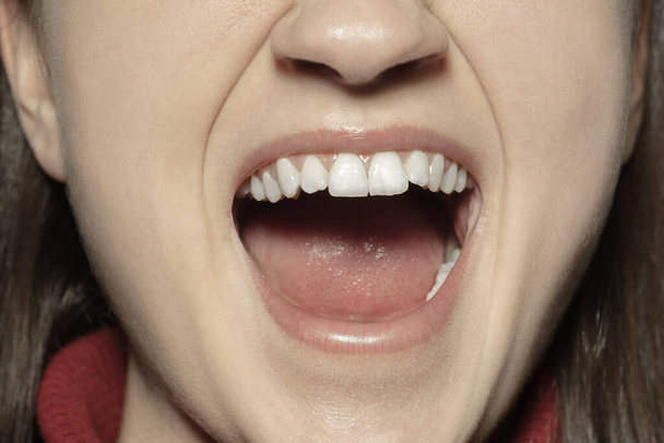 Close-up boca feminina com lábios naturais nua brilho make-up. Cosmetologia, odontologia e cuidados de beleza, emoções
 - Foto, Imagem