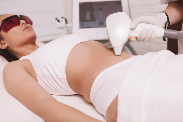 Femme obtenant les cheveux indésirables enlevés sur son ventre au traitement d'épilation au laser
 - Photo, image