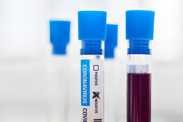 Blood samples for coronavirus disease test, Covid-19 - Photo, Image
