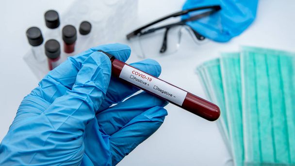 Un technicien de laboratoire tient la main sur un tube de prélèvement sanguin pour un test de dépistage du virus corona, COVID-19. Scientifique avec des gants bleus pour la protection. Recherche sur les vaccins pour le 2019-nCoV
 - Photo, image