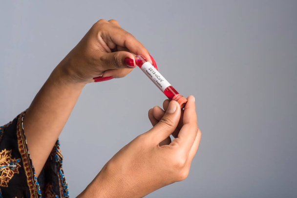 Young girl holding a test tube with blood sample for coronavirus or 2019-nCoV analyzing. - Foto, Bild