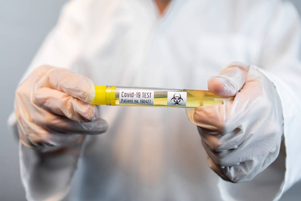 Biyolojik tehlike hastası gribi test tüpü laboratuarda. - Fotoğraf, Görsel