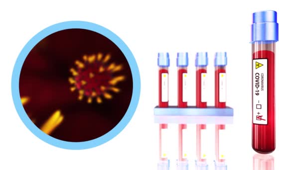 Bluttest Pandemie Diagramme 4K China COVID 19 Coronavirus Ausbruch Mikroskop Animation .2019 ncov Hintergrund. Virus gefährlich. Grippewarnung - Filmmaterial, Video