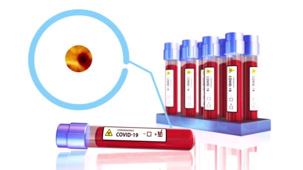 Bloedonderzoek pandemische grafieken 4K China COVID 19 Coronavirus uitbraak microscoop animatie .2019 ncov achtergrond. virus gevaarlijk. griepalarm - Video