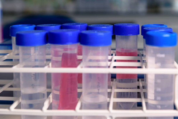 Um close-up de tubos de plástico de laboratório usado para pesquisa de coronavírus
 - Foto, Imagem