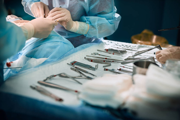 As mãos dos cirurgiões estão segurando uma ferramenta cirúrgica na sala de cirurgia. Close-up, bela luz, medicina moderna, Salvando vidas
. - Foto, Imagem