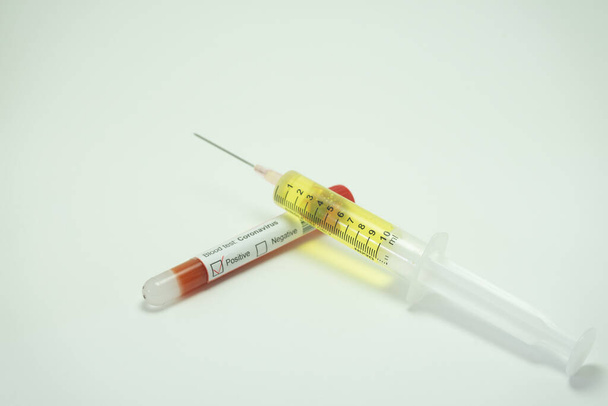 Коронавірусна вакцина поруч з трубкою крові, яка вказує на позитивний результат для цієї хвороби. 2019-NcOv впливає на багато країн, але особливо в Китаї, Італії та Іспанії.. - Фото, зображення