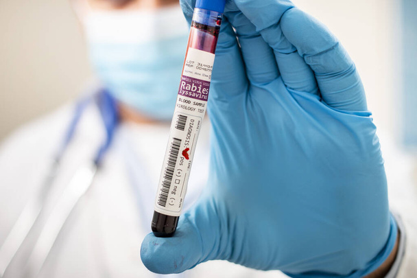 View of a doctor holding a fictional test tube blood sample, infected with rabies virus. - Photo, image