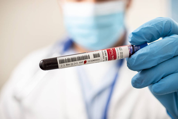 Άποψη ενός γιατρού που κατέχει ένα φανταστικό δείγμα αίματος δοκιμαστικό σωλήνα, μολυσμένο με HIV / AIDS. - Φωτογραφία, εικόνα